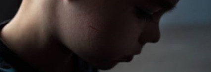 როგორ მოვიქცეთ, თუ ბავშვი ბულინგის მსხვერპლია?