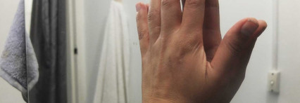 რატომ აყენებენ  მოზარდები საკუთარ სხეულს ზიანს?